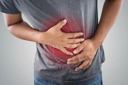 Inflammatory Bowel Disease